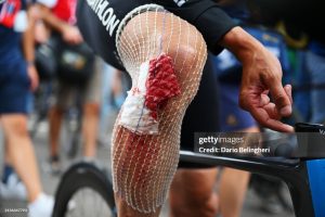 gettyimages-2156347793-1024x1024
