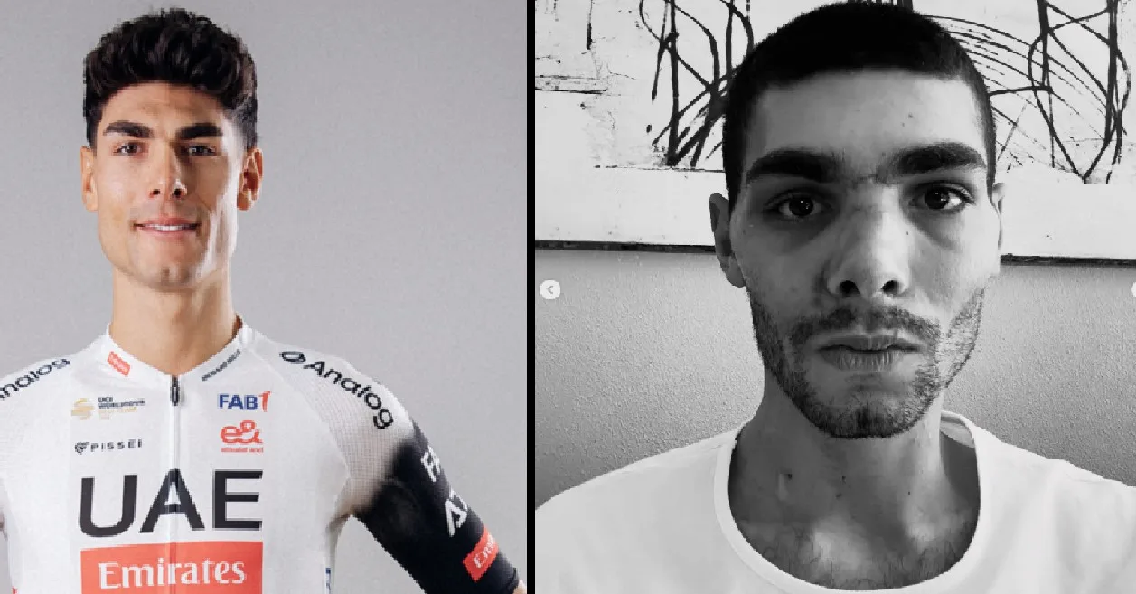 Filippo Baroncini, UAE