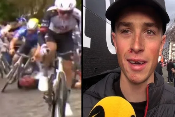 Rick Pluimers (Tudor) tras su caída en Omloop 2026 que lo dejó con dientes rotos.